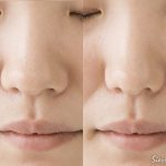 Photoshopによる鼻の整形シミュレーション。どのレベルまで修正すると満足となるのか・・・